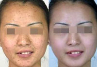 ���ݷ���Ƥ����ҽԺ