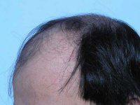 ���ݷ���Ƥ����ҽԺ