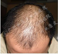 广州肤康皮肤病医院