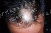 广州肤康皮肤病医院