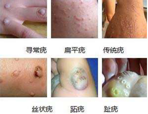 广州肤康皮肤病医院