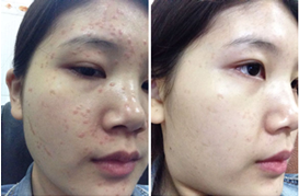 广州肤康皮肤病医院