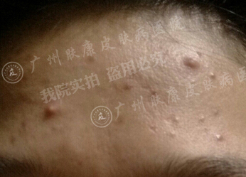 广州肤康皮肤病医院