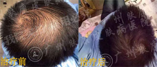 ���ݷ���Ƥ����ҽԺ