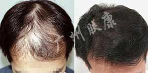 ���ݷ���Ƥ����ҽԺ