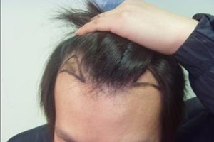 广州肤康皮肤病医院