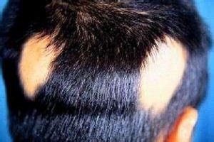 广州肤康皮肤病医院