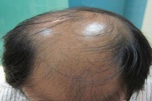 广州肤康皮肤病医院