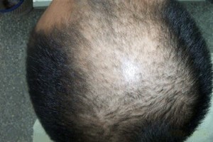 广州肤康皮肤病医院