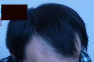 广州肤康皮肤病医院