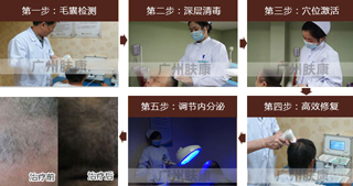 广州肤康皮肤病医院