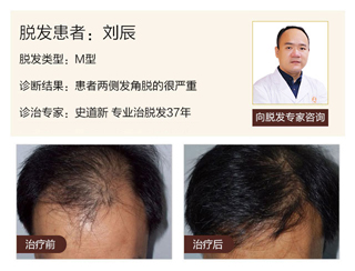 广州肤康皮肤病医院