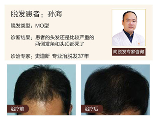 广州肤康皮肤病医院