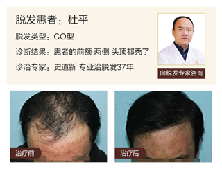 广州肤康皮肤病医院