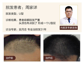 广州肤康皮肤病医院