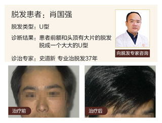 广州肤康皮肤病医院