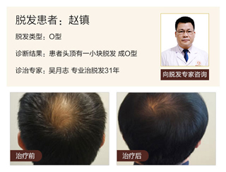 广州肤康皮肤病医院