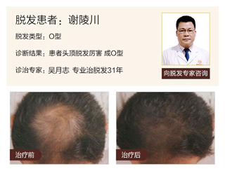 广州肤康皮肤病医院