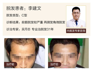 广州肤康皮肤病医院