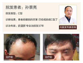 广州肤康皮肤病医院